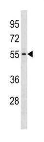 Glycosyltransferase-Like Domain Containing Protein 1 (GTDC1) Antibody
