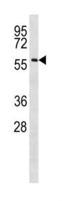 Coiled-Coil Domain Containing 155 (CCDC155) Antibody