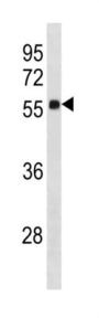 Zinc Finger Protein 502 (ZNF502) Antibody