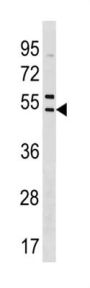 SNX5 Antibody