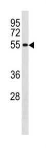 G2/mitotic-Specific Cyclin-B1 (CCNB1) Antibody