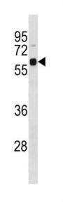 Ubiquilin 4 (UBQLN4) Antibody
