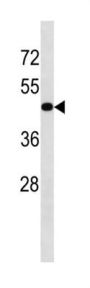 Transforming Growth Factor Beta Receptor 1 (TGFBR1) Antibody