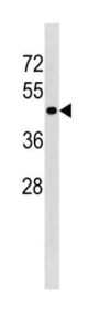 Transforming Growth Factor Beta Receptor 1 (TGFBR1) Antibody