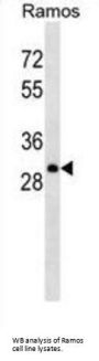 lambda light chain Antibody