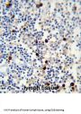 lambda light chain Antibody