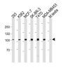 Angiotensin-Converting Enzyme 2 (ACE2) Antibody