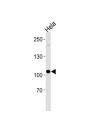 UBE3C Antibody