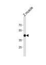 DANRE atf4 Antibody