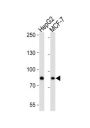 Ubiquitin Carboxyl-Terminal Hydrolase 51 (USP51) Antibody