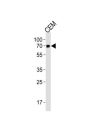 Guanylate-Binding Protein 2 (GBP2) Antibody