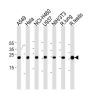 CCAAT/Enhancer Binding Protein Delta (CEBPD) Antibody