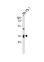 Interleukin 3 Receptor alpha (IL3RA) Antibody