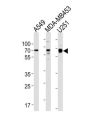 Growth Factor Receptor Bound Protein 10 (GRB10) Antibody