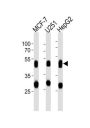 Cathepsin D (CTSD) Antibody