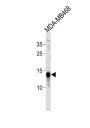 Tumor Protein D52 Like 3 (TPD52L3) Antibody