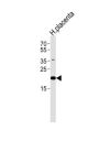 Uncharacterized Protein C2orf74 (C2orf74) Antibody