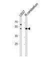 SLC25A25 Antibody