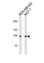 Angiotensin-Converting Enzyme 2 (ACE2) Antibody