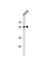 Periphilin 1 (PPHLN1) Antibody