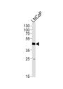 FAM54A Antibody