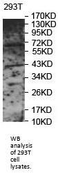 Polypeptide N-Acetylgalactosaminyltransferase 4 (GALNT4) Antibody