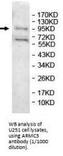 Armadillo Repeat Containing 3 (ARMC3) Antibody