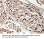 Leucine-Rich Repeats And Immunoglobulin-Like Domains Protein 2 (LRIG2) Antibody