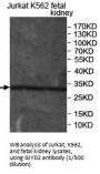 Structure-Specific Endonuclease Subunit SLX1 (SLX1B) Antibody