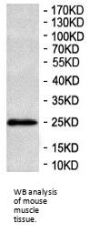 RAB27A, Member RAS Oncogene Family (RAB27A) Antibody