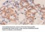 Vascular Endothelial Growth Factor A (VEGFA) Antibody