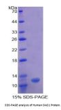 Human 2'-5'-Oligoadenylate Synthetase 1 (OAS1) Protein