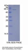 Rat 5'-Nucleotidase / CD73 (NT5E) Protein