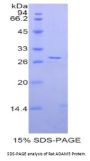 Rat A Disintegrin And Metalloprotease 5 (ADAM5) Protein
