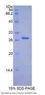 Human A Disintegrin And Metalloprotease 9 (ADAM9) Protein