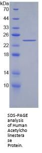 Human Acetylcholinesterase (AChE) Protein