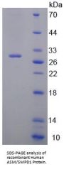 Human Sphingomyelin Phosphodiesterase (SMPD1) Protein