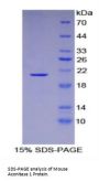 Mouse Aconitase 1 (ACO1) Protein