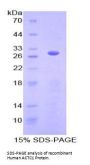 Human Actin Alpha 1, Cardiac Muscle (ACTC1) Protein