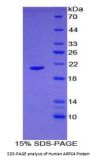 Human Actin Related Protein 2/3 Complex Subunit 4 (ARPC4) Protein