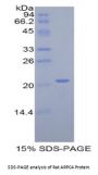 Rat Actin Related Protein 2/3 Complex Subunit 4 (ARPC4) Protein
