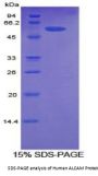 Human Activated Leukocyte Cell Adhesion Molecule / CD166 (ALCAM) Protein