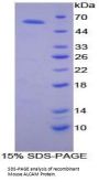 Mouse Activated Leukocyte Cell Adhesion Molecule / CD166 (ALCAM) Protein