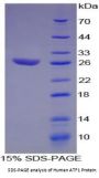 Human Activating Transcription Factor 1 (ATF1) Protein