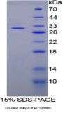 Rat Activating Transcription Factor 1 (ATF1) Protein