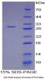 Human Activating Transcription Factor 4 (ATF4) Protein