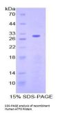 Human Activating Transcription Factor 6 (ATF6) Protein