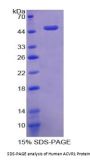 Human Activin A Receptor Type I (ACVR1) Protein