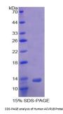 Human Activin A Receptor Type 1B (ACVR1B) Protein