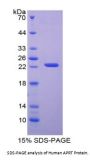 Human Adenine Phosphoribosyltransferase (APRT) Protein